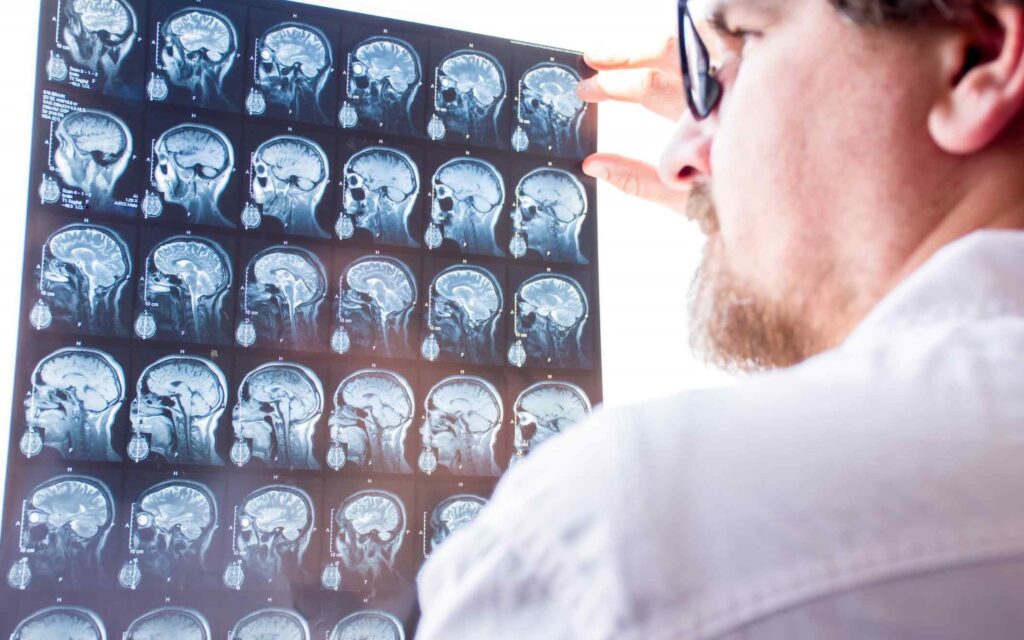 What Compensation Available For Traumatic Brain Injury Victims in Miami - Call 305-390-4259