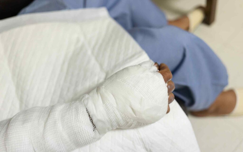 How Miami Personal Injury Attorney Handle Severe Burn Injury Cases? - Call 305-390-4259